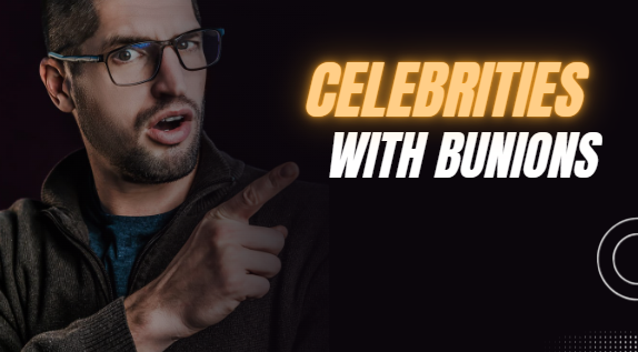 Celebrities with bunions